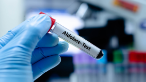 Aldolaz Testi