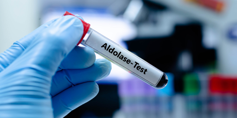 Aldolaz Testi