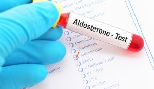 Aldosteron Testi