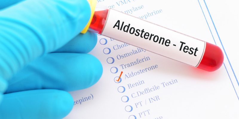 Aldosteron Testi