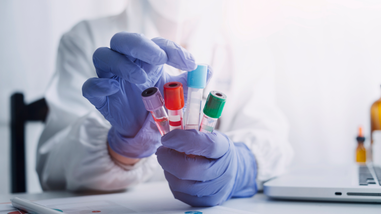 Alfa-Galaktosidaz Testi