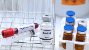 Anti HDV Total Testi