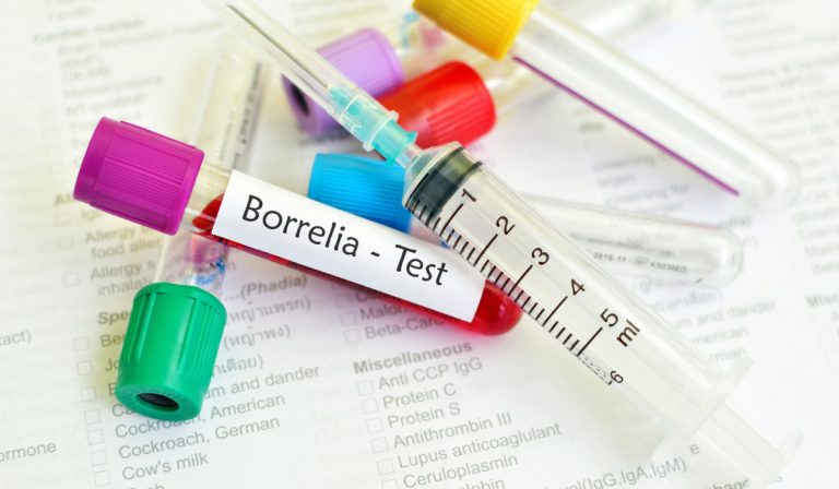 Borrelia Burgdorferi IgG Testi