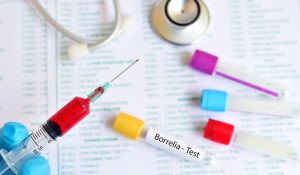 Borrelia Burgdorferi IgM Testi