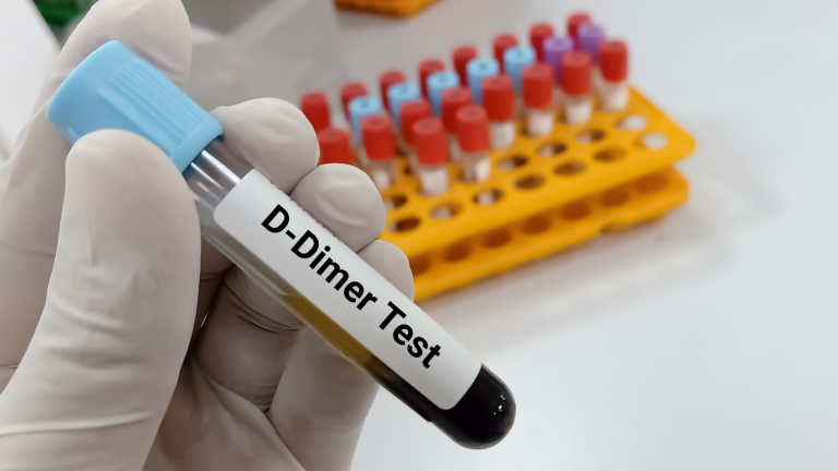 D-Dimer Testi
