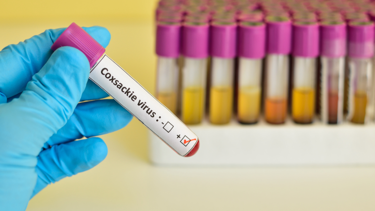 Enterovirüs (Coxsackie Virüs) IgG Testi