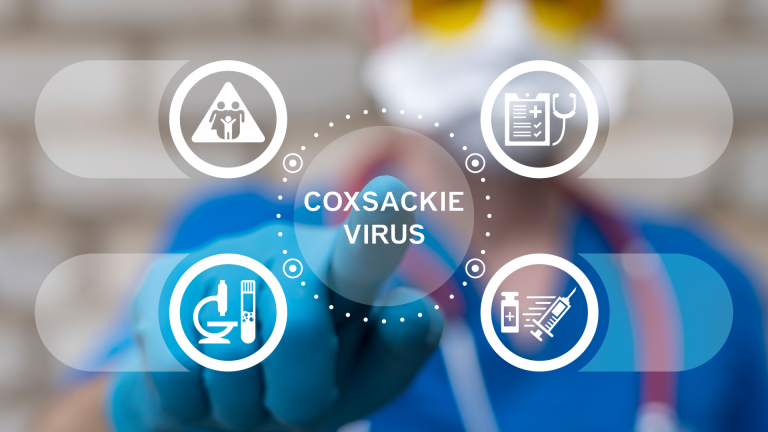 Enterovirüs (Coxsackie Virüs) IgM Testi