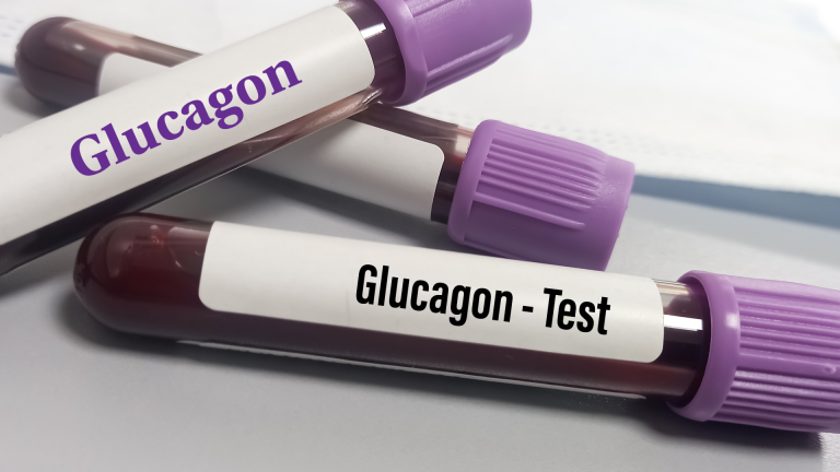 Glukagon Testi