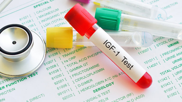 Somatomedin C (IGF-1) Testi