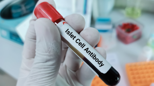 ICA Adacık (Islet) Hücre Antikoru Testi