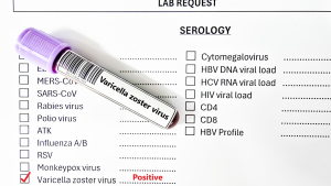 VZV (Varicella Zoster) IgM Testi