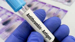 Anti Trombin III Antijeni Testi