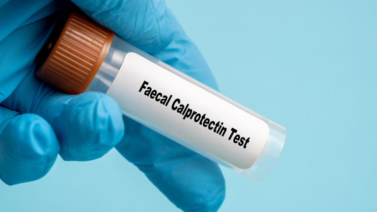 Kalprotektin Testi