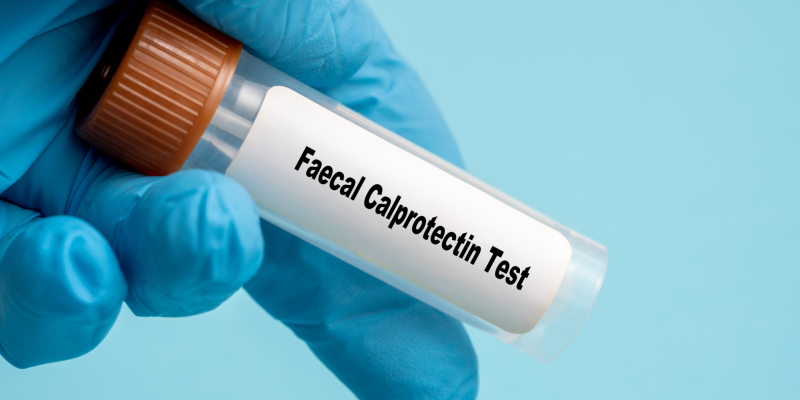 Kalprotektin Testi