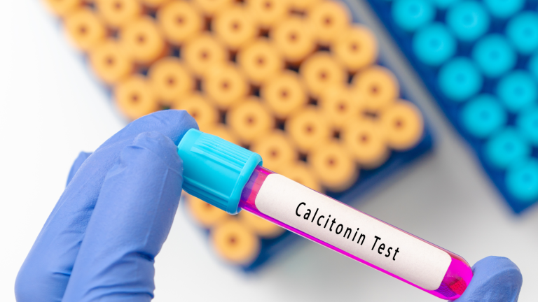 Kalsitonin Testi