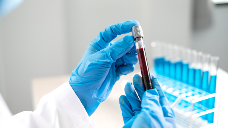 Kist Hidatik (IHA) Testi