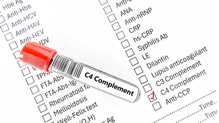 Kompleman C4 Testi