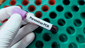 Parvovirüs B19 PCR Testi