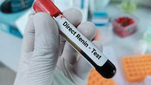 Plazma Renin Aktivitesi (Angiotensin I) Testi