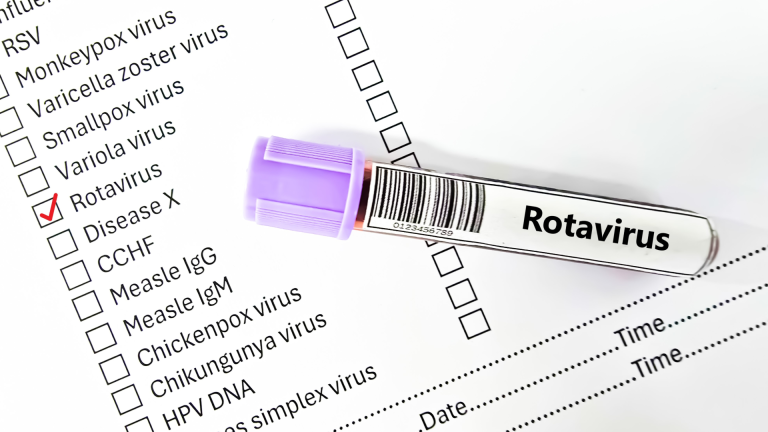 Rotavirüs Testi