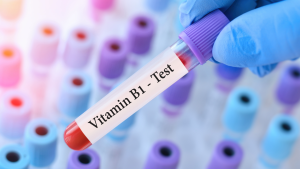 Vitamin B1 (Tiamin) Testi