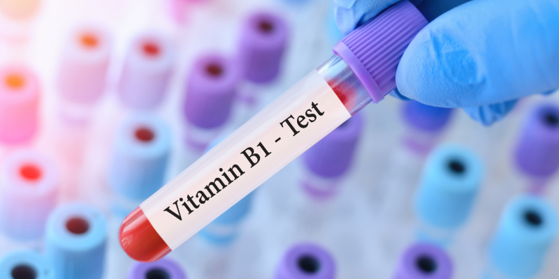 Vitamin B1 (Tiamin) Testi