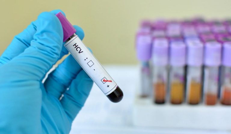 HCV Genotiplendirme Testi