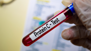 Protein C Aktivitesi Testi