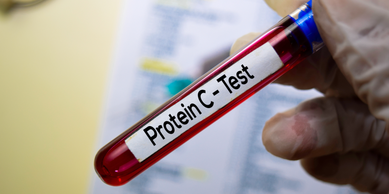 Protein C Aktivitesi Testi