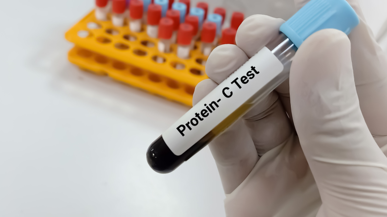 Protein C Antijeni Testi