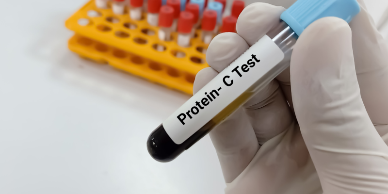 Protein C Antijeni Testi