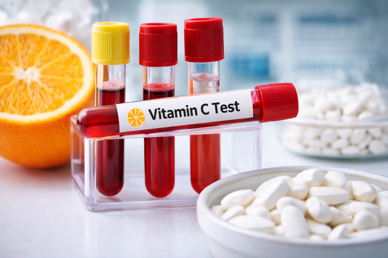 Vitamin C Testi