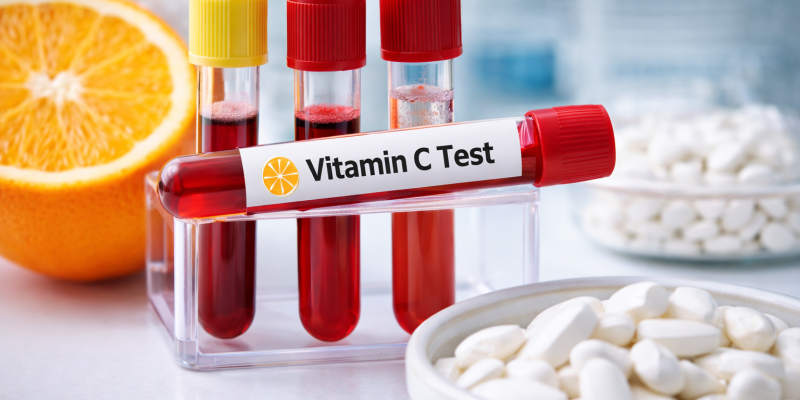 Vitamin C Testi