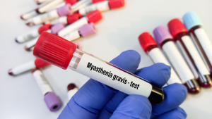 ACHR (Asetilkolin Reseptör Antikoru) Testi