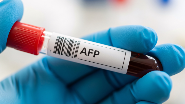 AFP Testi