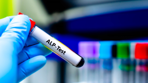 ALP Testi