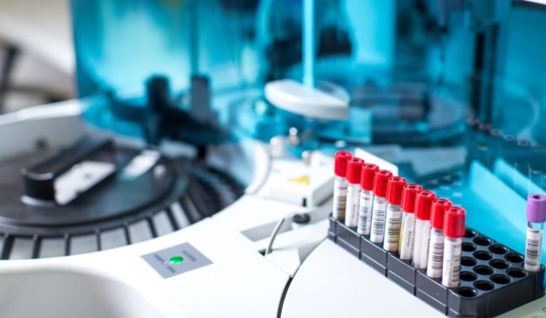 ASCA (Saccharomyces Cerevisiae) IgA Testi Nedir?