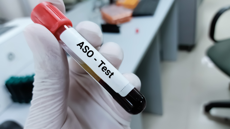ASO Testi