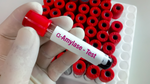 Amilaz Testi