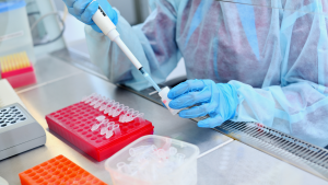 Anti MuSK Antikoru Testi