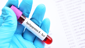 Apo B (Apolipoprotein B) Testi