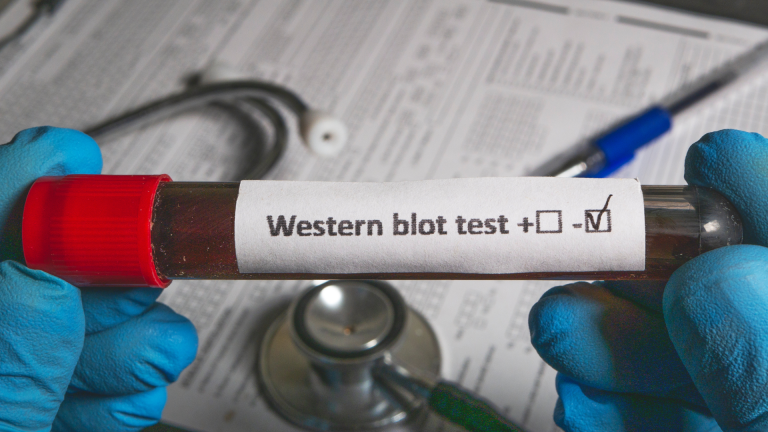 Borrelia Burgdorferi Western Blot IgG