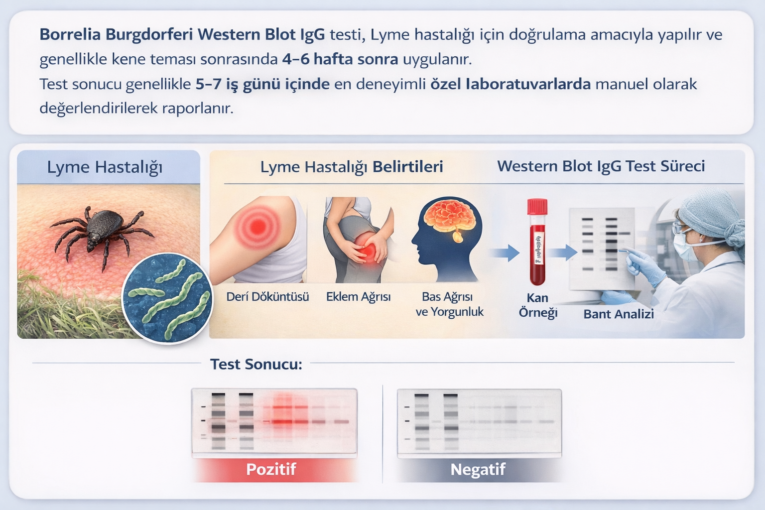 Borrelia Burgdorferi Western Blot IgG