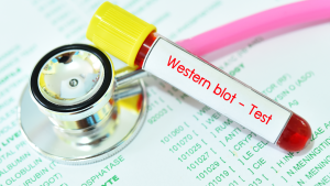 Borrelia Burgdorferi Western Blot IgM