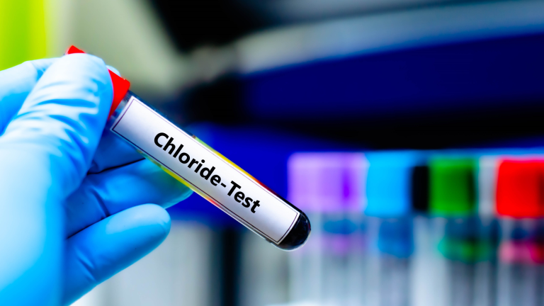 Klor Testi