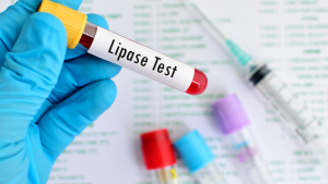 Lipaz Testi