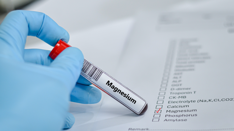 Magnezyum Testi