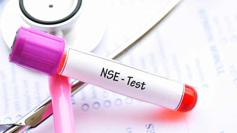 Nöron Spesifik Enolaz (NSE) Testi