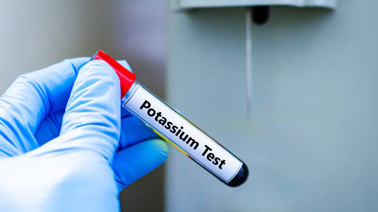 Potasyum Testi