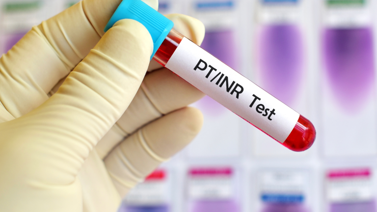 Protrombin Zamanı (INR) Testi